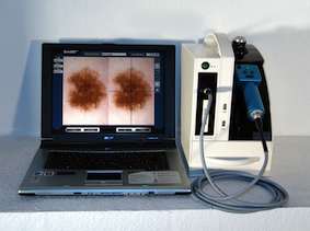 Mole-Scanner